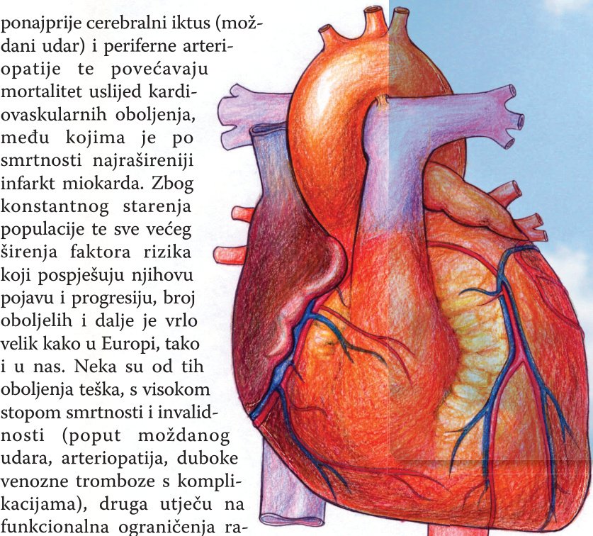 Infarkt je uvijek iznenadan?