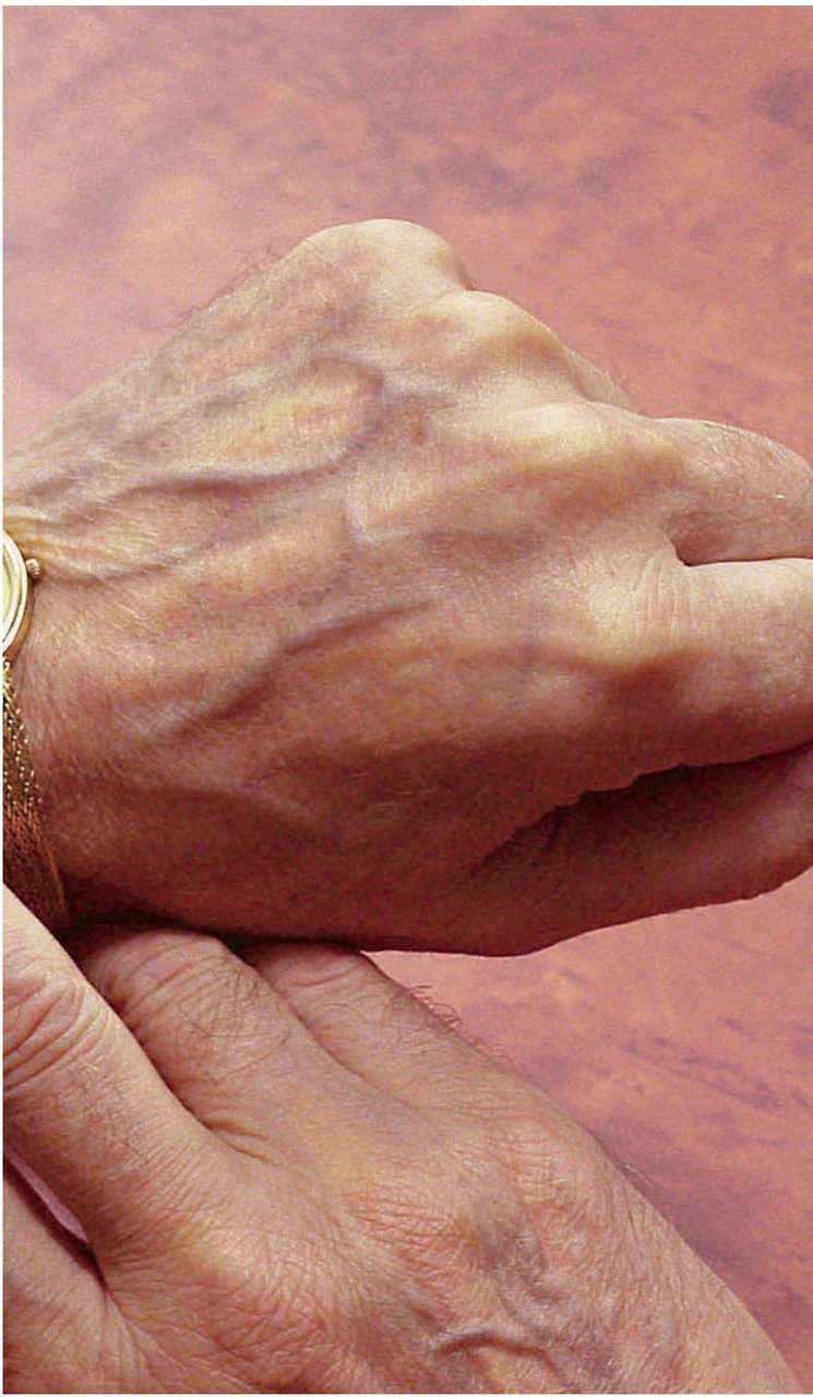 Neovisnost u Podravci? Ljubo Jurčić