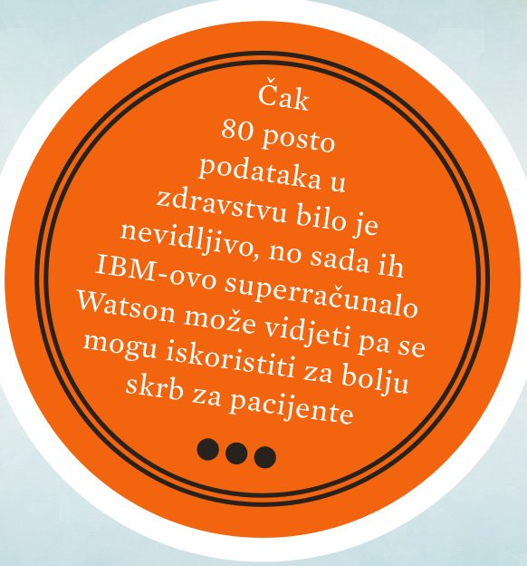 Brizna strana superracunala